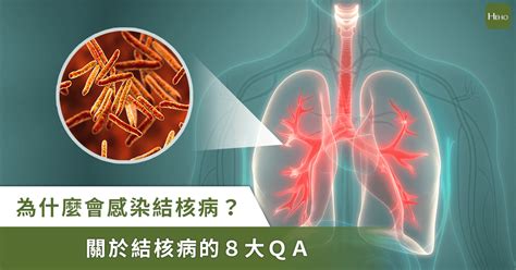 孩童咳嗽|久咳不癒？小兒咳嗽全面解析8大QA